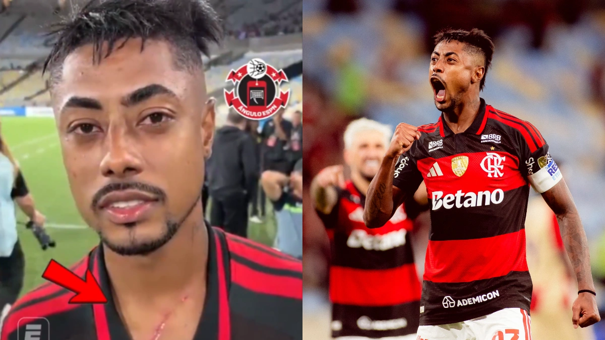Bruno Henrique sai de campo com machucado assustador em jogo do Flamengo x Medellín