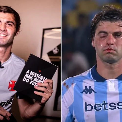 Sosa admite ansiedade para enfrentar o Flamengo